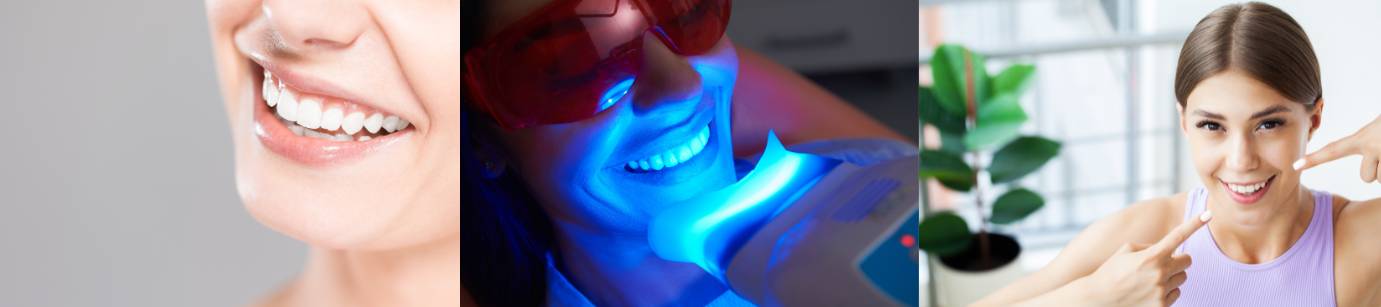 3 Photos related to teeth whitening