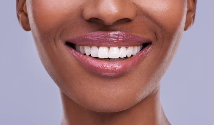 Are Veneers All Hype, Or Are They Worth It? Everything You Need to Know